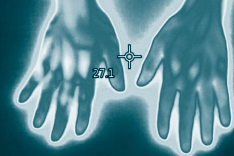 Medical Thermography